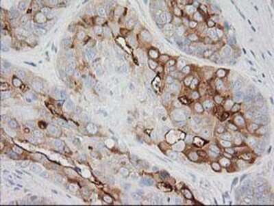 Immunohistochemistry-Paraffin: BAIAP2 Antibody (OTI 1D9) [NBP2-00810]