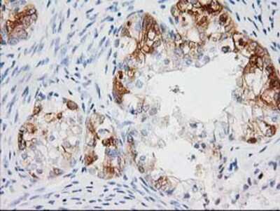 Immunohistochemistry-Paraffin: BAIAP2 Antibody (OTI 1D9) [NBP2-00810]