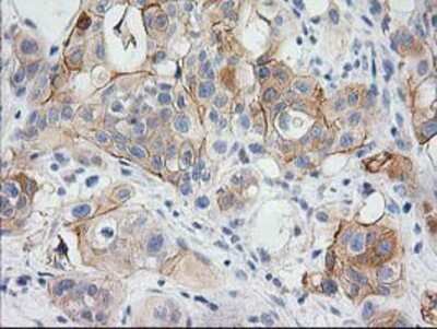 Immunohistochemistry-Paraffin: BAIAP2 Antibody (OTI 1D9) [NBP2-00810]