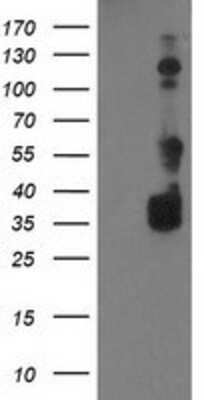 Western Blot: BAIAP2 Antibody (OTI 1D9) [NBP2-00810]