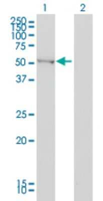 Western Blot: BAIAP2 Antibody (3F3-2D3) [H00010458-M01]