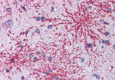 Immunohistochemistry-Paraffin: BAIAP2 Antibody [NB100-827]