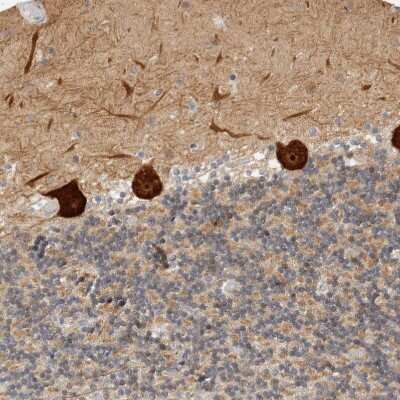 Immunohistochemistry-Paraffin: BAIAP2 Antibody [NBP1-88710]