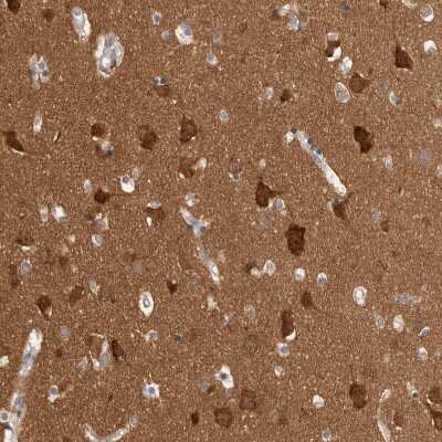 Immunohistochemistry-Paraffin: BAIAP2 Antibody [NBP1-88710]