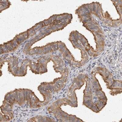 Immunohistochemistry-Paraffin: BAIAP2 Antibody [NBP1-88710]