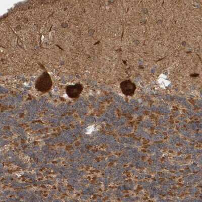 Immunohistochemistry-Paraffin: BAIAP2 Antibody [NBP1-88711]