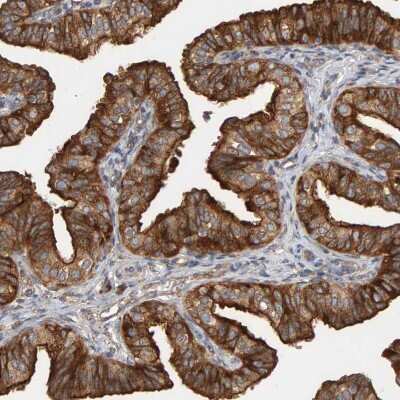 Immunohistochemistry-Paraffin: BAIAP2 Antibody [NBP1-88711]