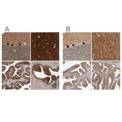 Immunohistochemistry-Paraffin: BAIAP2 Antibody [NBP1-88711]