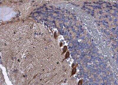 Immunohistochemistry-Paraffin: BAIAP2 Antibody [NBP2-15545]
