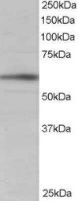 Western Blot: BAIAP2 Antibody [NB100-827]