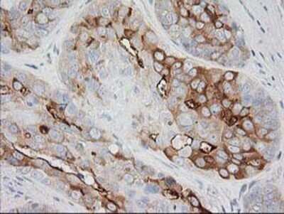 Immunohistochemistry: BAIAP2 Antibody (OTI 1D9) - Azide and BSA Free [NBP2-71603]