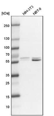 Western Blot: BAIAP2 Antibody [NBP1-88710]