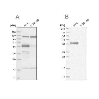 Western Blot: BAIAP2 Antibody [NBP1-88710]