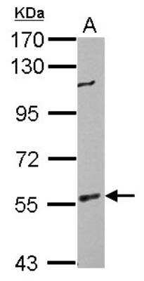 Western Blot: BAIAP2 Antibody [NBP2-15545]