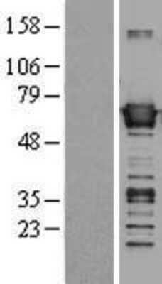 Western Blot: BAIAP2 Overexpression Lysate [NBL1-07906]