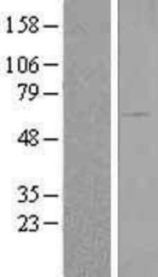 Western Blot: BAIAP2 Overexpression Lysate [NBL1-07907]