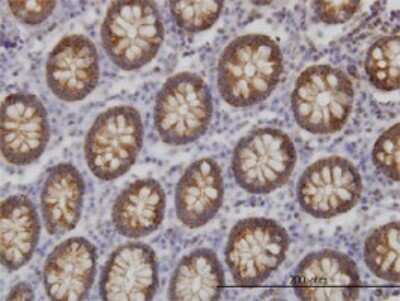 Immunohistochemistry-Paraffin: BAIAP2L1 Antibody (2A4) [H00055971-M01]