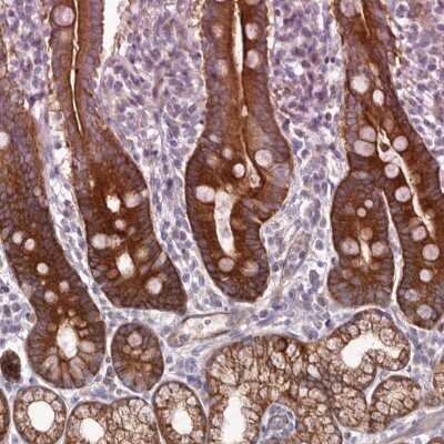 Immunohistochemistry-Paraffin: BAIAP2L1 Antibody [NBP1-85940]
