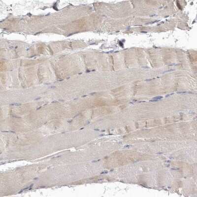 Immunohistochemistry-Paraffin: BAIAP2L1 Antibody [NBP1-85940]