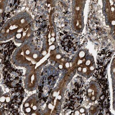 Immunohistochemistry-Paraffin: BAIAP2L1 Antibody [NBP1-89537]