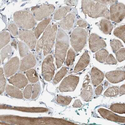 Immunohistochemistry-Paraffin: BAIAP2L1 Antibody [NBP1-89537]