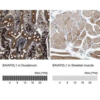 Immunohistochemistry-Paraffin: BAIAP2L1 Antibody [NBP1-89537]