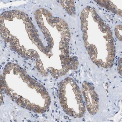 Immunohistochemistry-Paraffin: BAIAP2L1 Antibody [NBP1-89542]