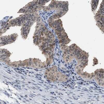Immunohistochemistry-Paraffin: BAIAP2L1 Antibody [NBP1-89542]