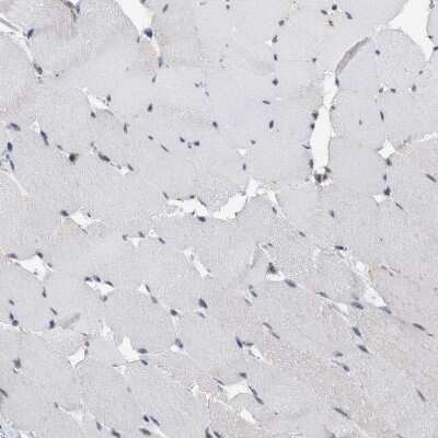 Immunohistochemistry-Paraffin: BAIAP2L1 Antibody [NBP1-89542]
