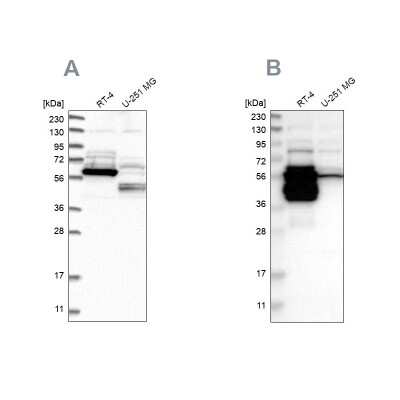 Western Blot: BAIAP2L1 Antibody [NBP1-89528]
