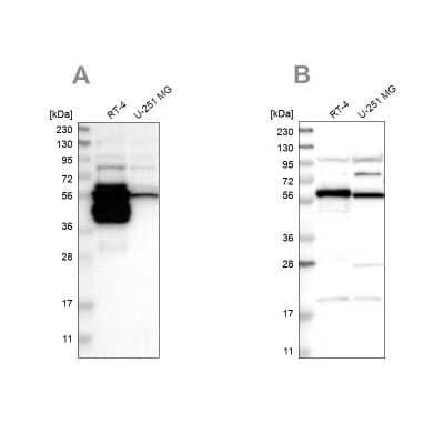 Western Blot: BAIAP2L1 Antibody [NBP1-89542]