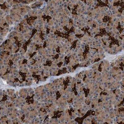 Immunohistochemistry-Paraffin: BAIAP3 Antibody [NBP1-88709]