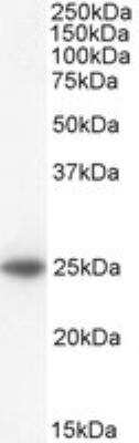 Western Blot: BAK Antibody [NB100-893]