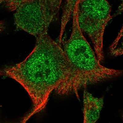 Immunocytochemistry/ Immunofluorescence: BAL/PARP9 Antibody [NBP2-56376]