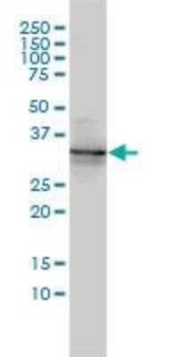 Western Blot: BAMBI/NMA Antibody (3C1-1D1) [H00025805-M01]