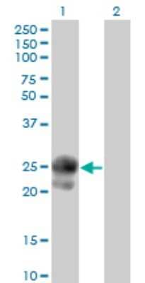 Western Blot: BAMBI/NMA Antibody (3C1-1D1) [H00025805-M01]