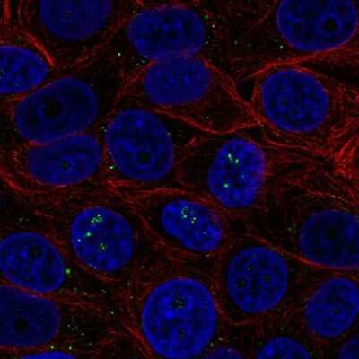 Immunocytochemistry/ Immunofluorescence: BAMBI/NMA Antibody [NBP2-58990]