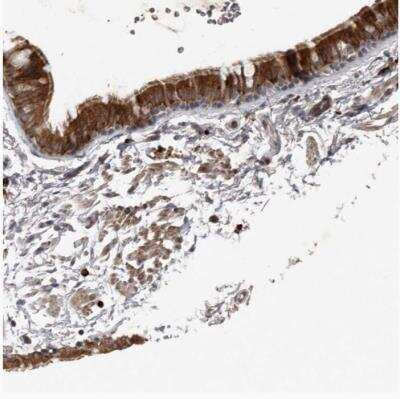 Immunohistochemistry-Paraffin: BAMBI/NMA Antibody [NBP1-82551]