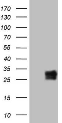 Western Blot: BAMBI/NMA Antibody (OTI5D5)Azide and BSA Free [NBP2-71778]