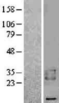 Western Blot: BAMBI/NMA Overexpression Lysate [NBL1-07910]