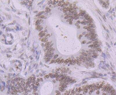 Immunohistochemistry: BANF1 Antibody (JG40-43) [NBP2-76978]