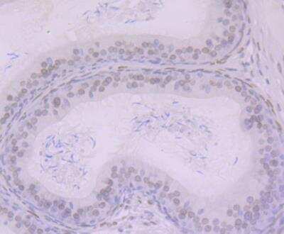 Immunohistochemistry: BANF1 Antibody (JG40-43) [NBP2-76978]