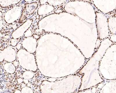 Immunohistochemistry-Paraffin: BANF1 Antibody (JG40-43) [NBP2-76978]