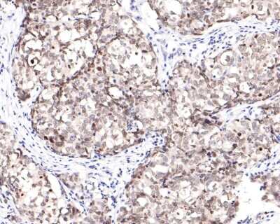 Immunohistochemistry-Paraffin: BANF1 Antibody (JG40-43) [NBP2-76978]