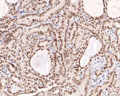 Immunohistochemistry-Paraffin: BANF1 Antibody (JG40-43) [NBP2-76978]