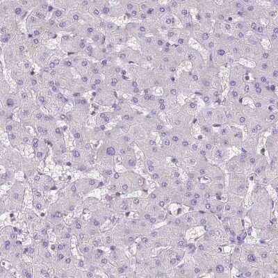 Immunohistochemistry-Paraffin: BANF2 Antibody [NBP1-88718]