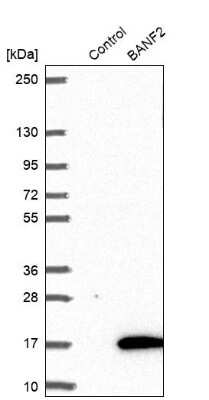 Western Blot: BANF2 Antibody [NBP1-88718]