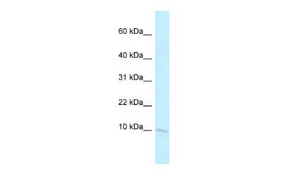 Western Blot: BANF2 Antibody [NBP2-82737]