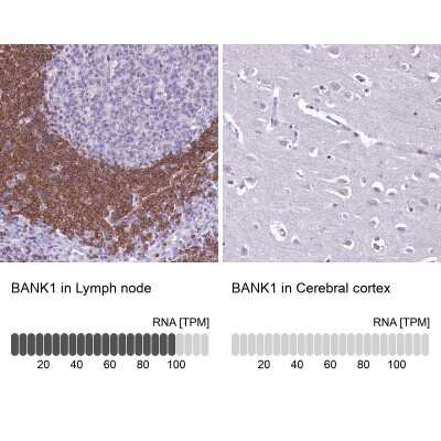 Immunohistochemistry-Paraffin: BANK1 Antibody [NBP1-88714]