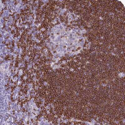 Immunohistochemistry-Paraffin: BANK1 Antibody [NBP1-88714]
